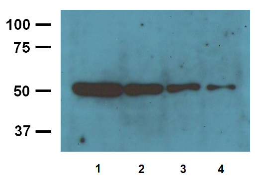 Anti-&beta;-Tubulin WB 01
